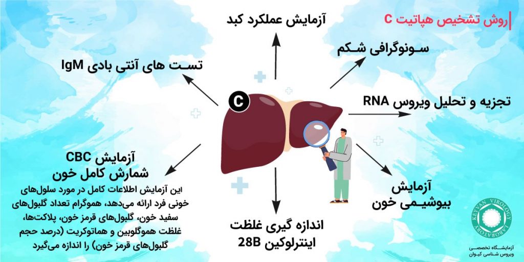 روش تشخیص هپاتیت C