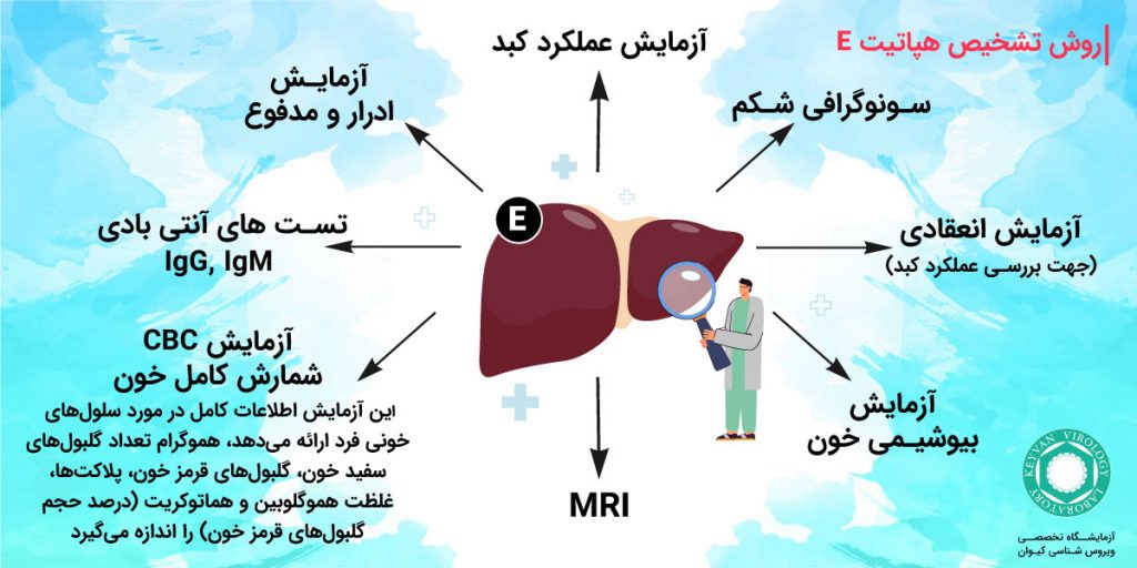 روش تشخیص هپاتیت E
