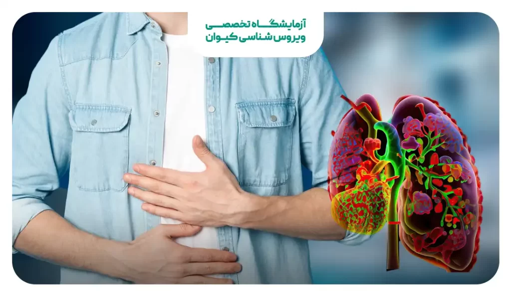 هپاتیت دی