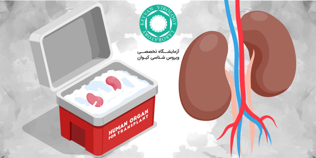 پیوند کلیه