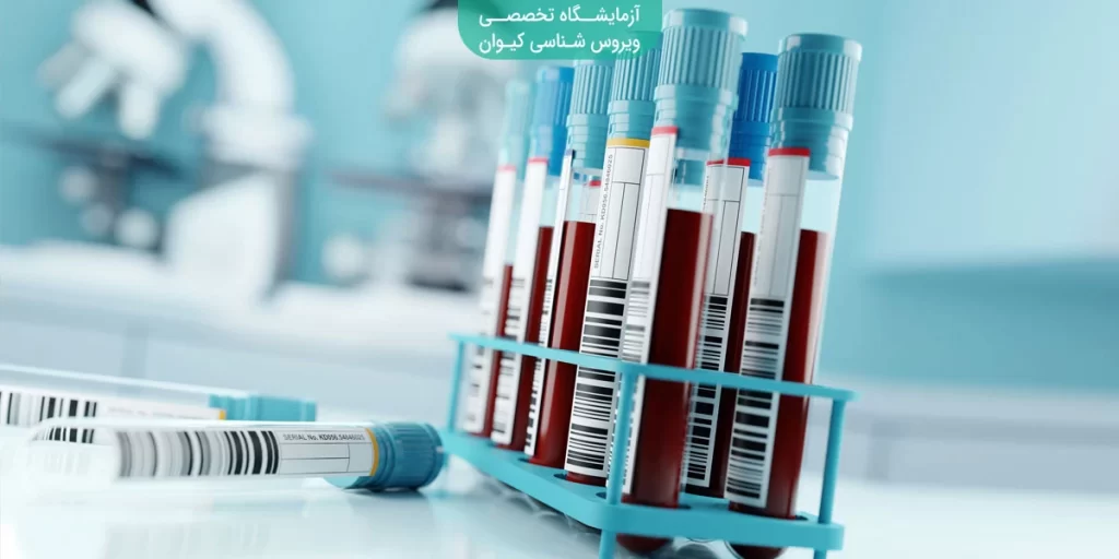 آزمایش خون و تشخیص بیماری