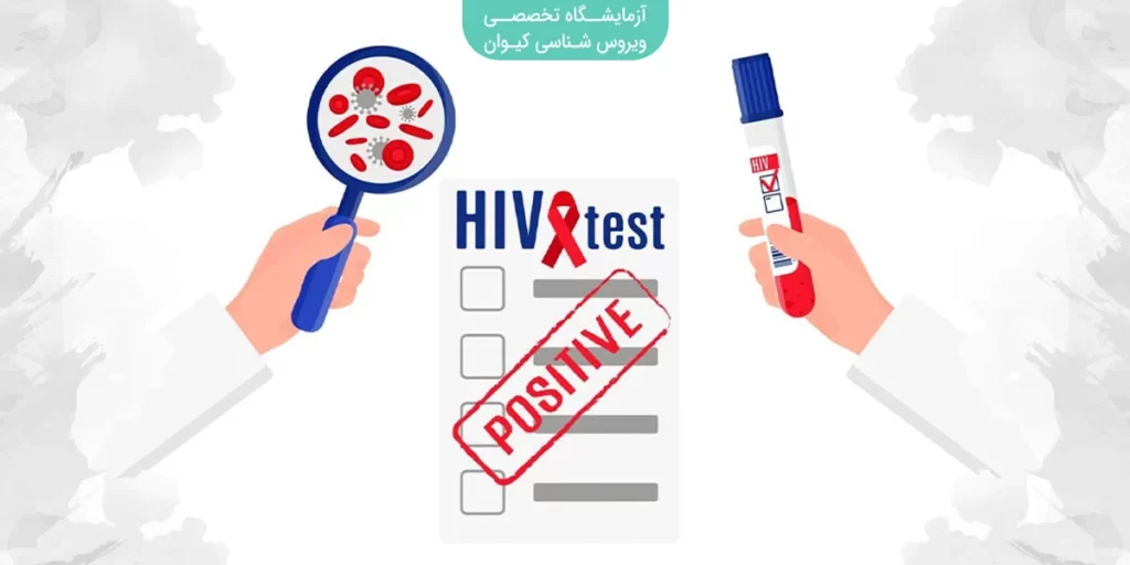 نتیجه مثبت یا منفی آزمایش HIV