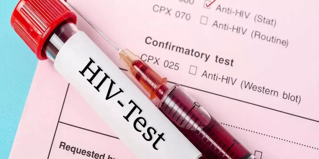 انواع آزمایش ایدز
