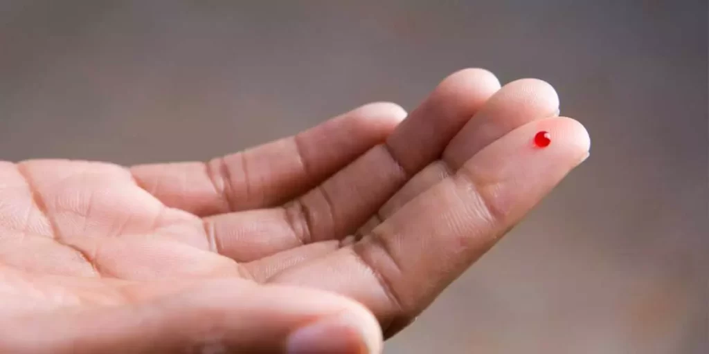 مثبت بودن آزمایش ایدز