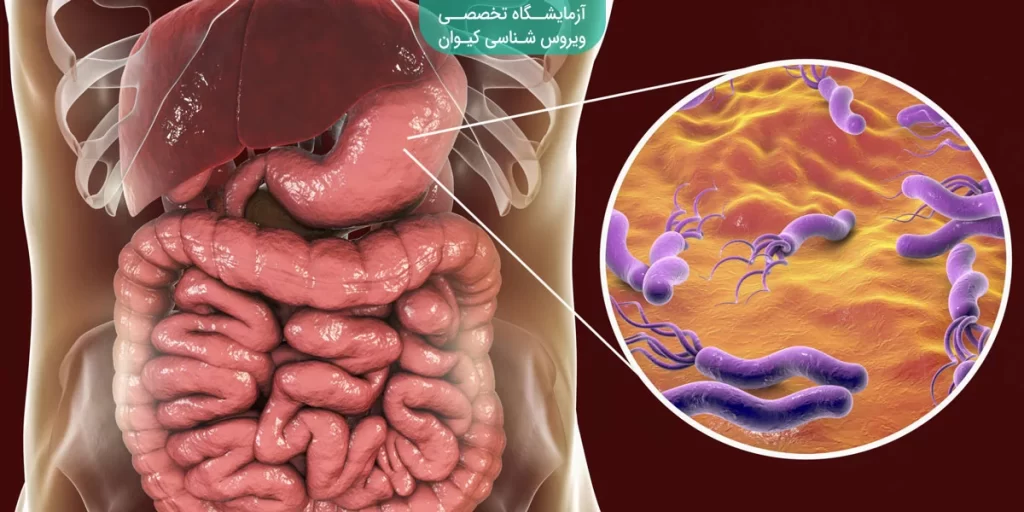 علل بروز بیماری عفونی