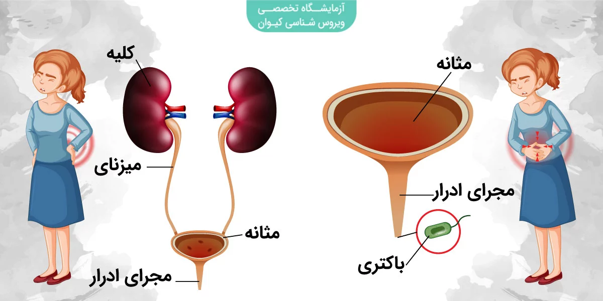 عفونت کلیه