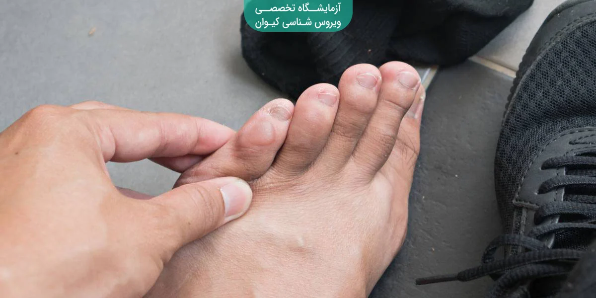 انواع تاول