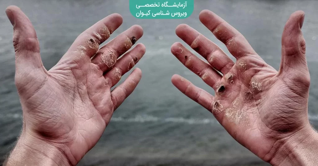 تاول دست