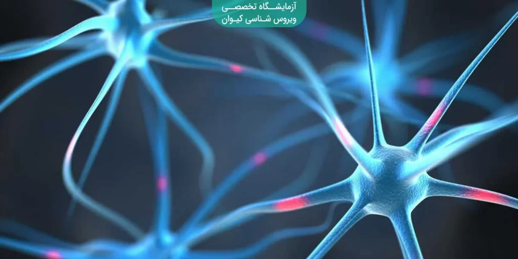 تشنج صرع