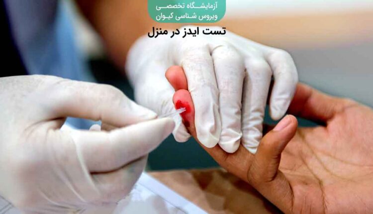 آزمایش ایدز