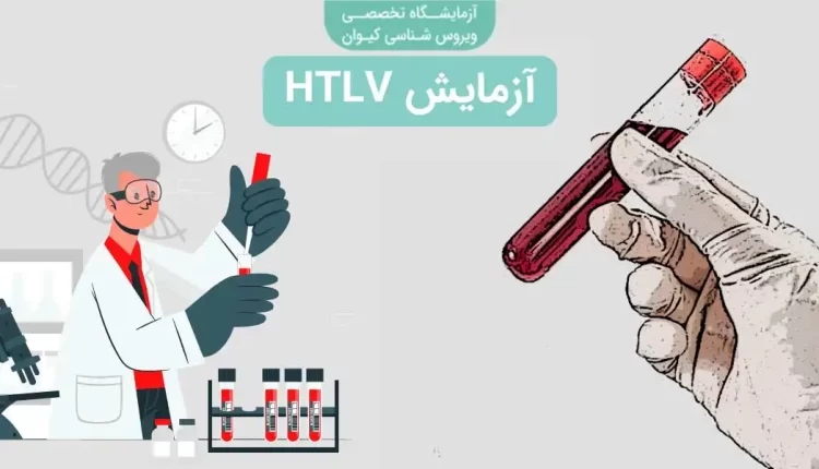 آزمایش HTLV
