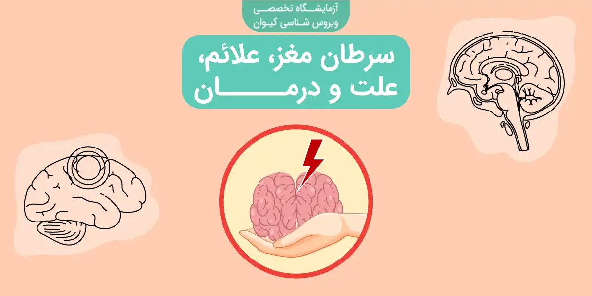 همه چیز درباره سرطان مغز، علائم، علت و درمان