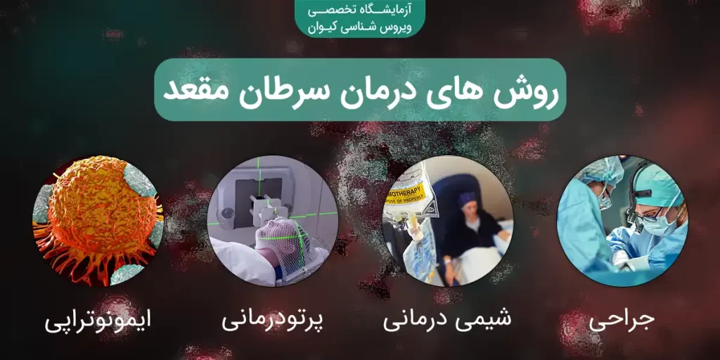 درمان سرطان مقعد