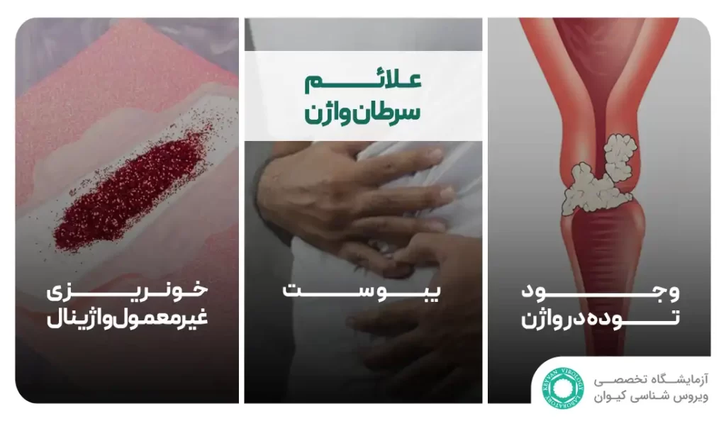 علائم سرطان واژن 2