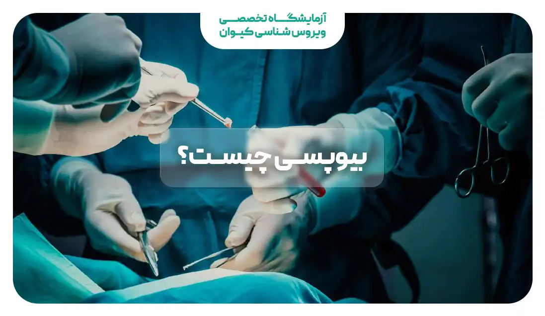 بیوپسی چیست؟