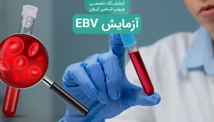 آزمایش EBV چیست؟ تشخیص ویروس اپشتین بار + تفسیر جواب EBV تست EBV - آزمایش EBV