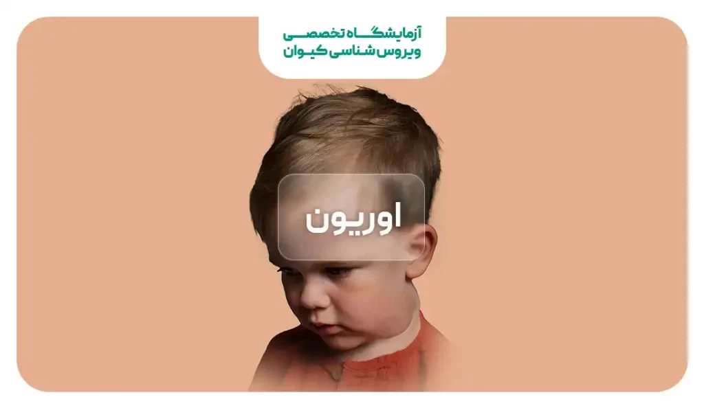 اوریون کودکان