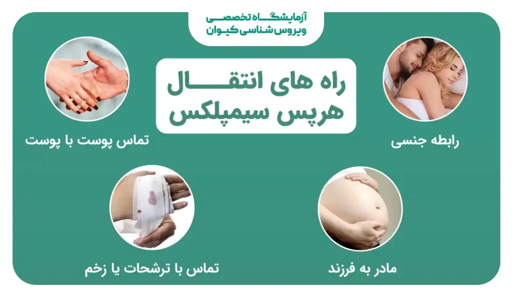 راه های انتقال هرپس سیمپلکس