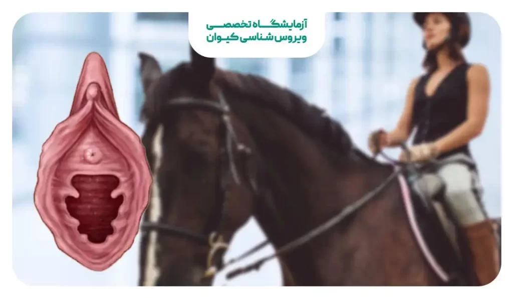 سوارکاری و پاره شدن پرده بکارت