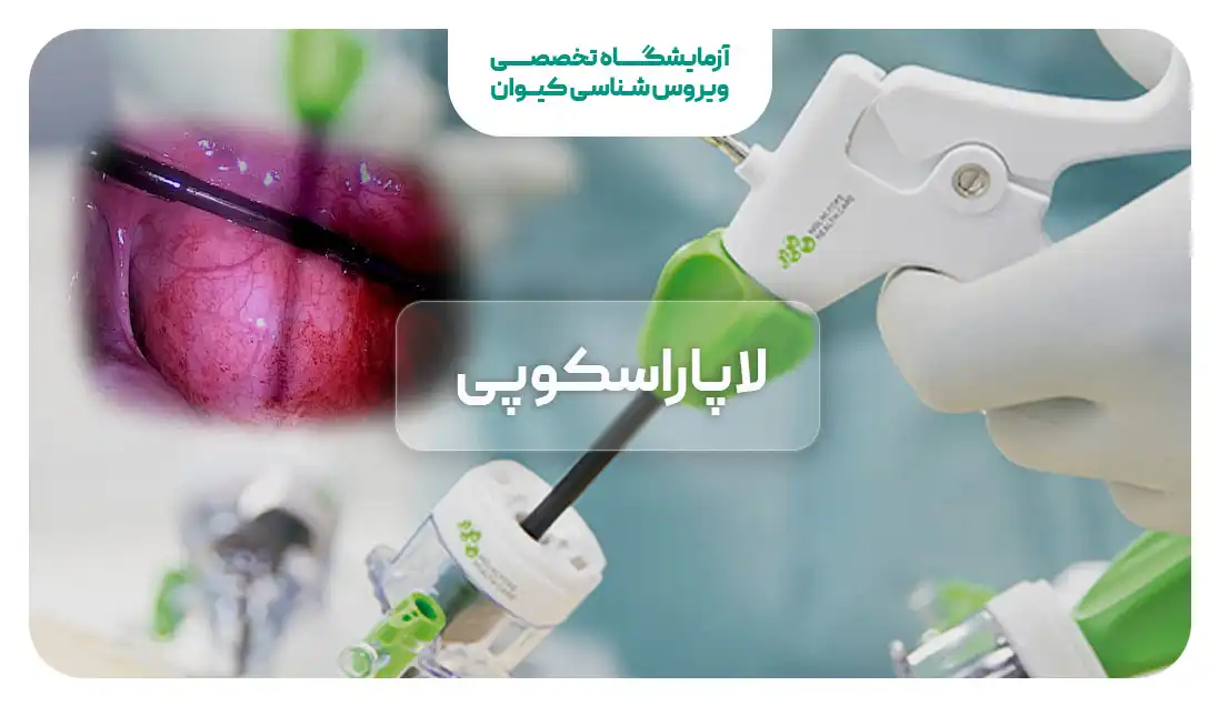 لاپاراسکوپی چیست؟