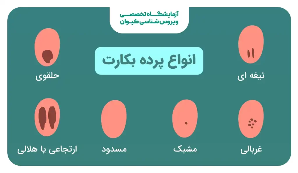 انواع پرده بکارت