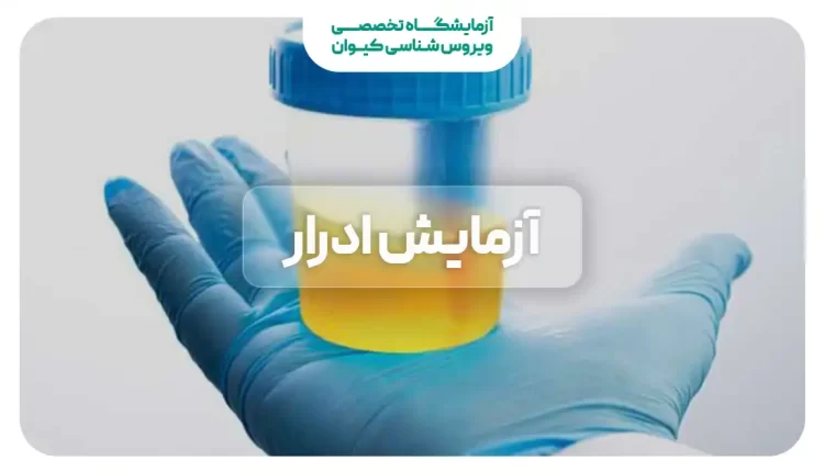 آزمایش ادرار چیست و چه زمانی انجام می شود؟ | آزمایش در منزل آزمایش ادرار - تست ادرار