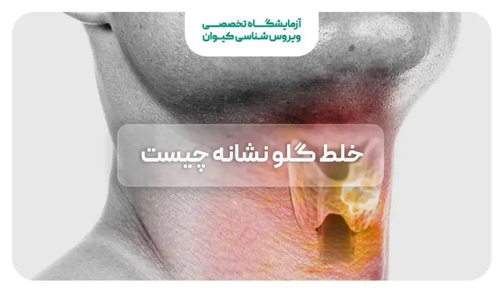 خلط پشت گلو