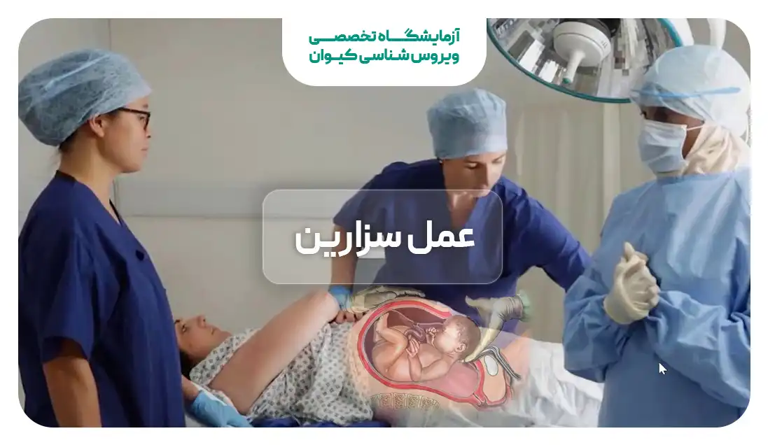 عمل زایمان سزارین