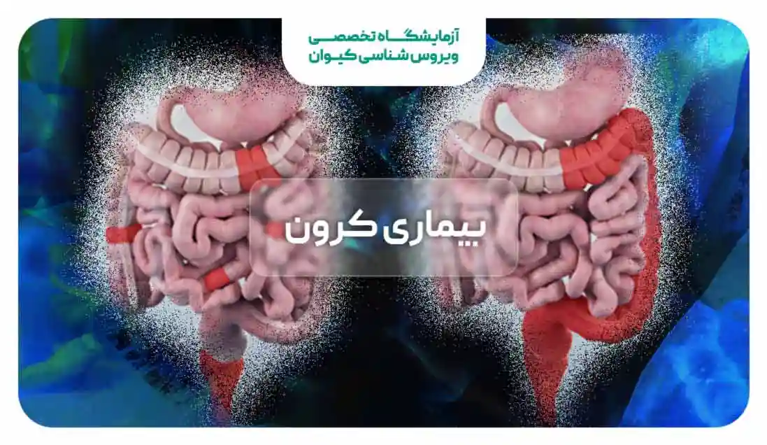 بیماری کرون چیست؟