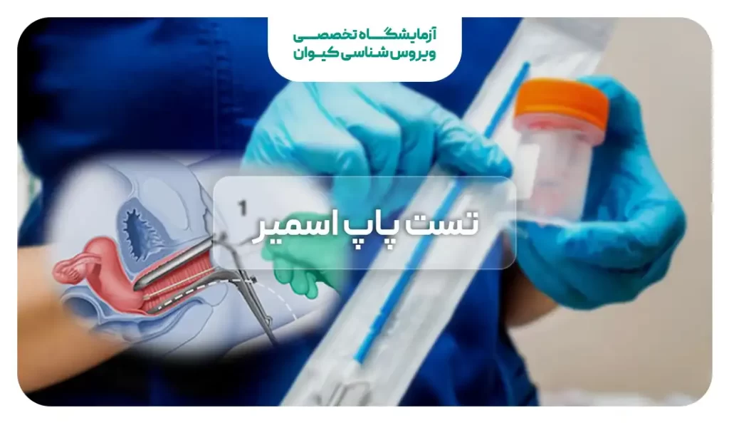 آزمایش پاپ اسمیر