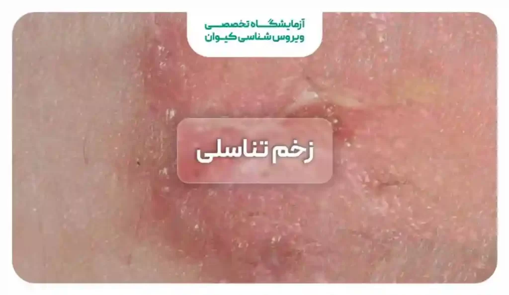 عکس زخم بیرونی واژن