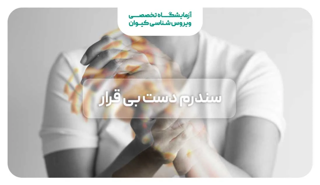 سندرم دست بی قرار