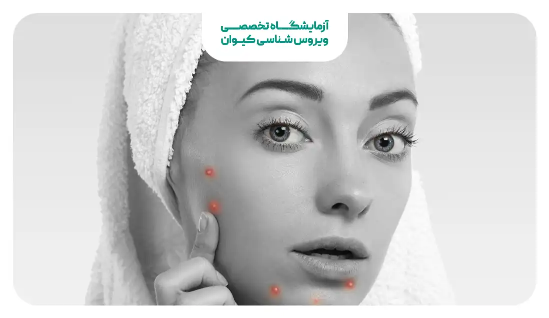 سبزی برای کاهش جوش صورت