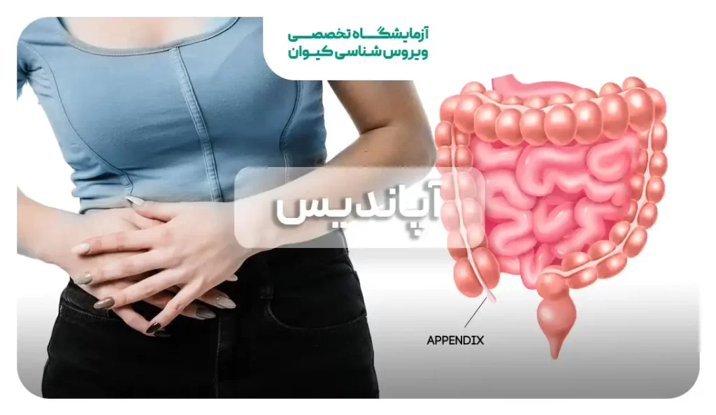 آپاندیس و بیماری آپاندیسیت را بیشتر بشناسید!