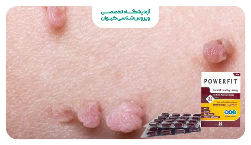 تاثیر قرص پاورفیت برای درمان زگیل تناسلی