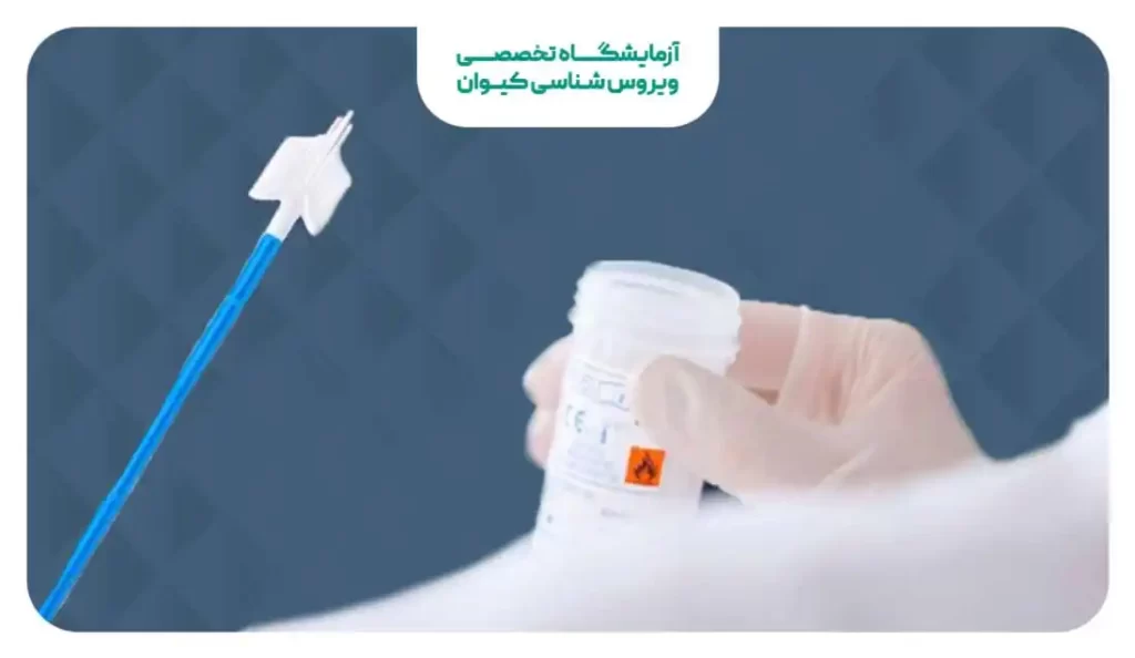 تست پاپ اسمیر برای تشخیص زگیل تناسلی
