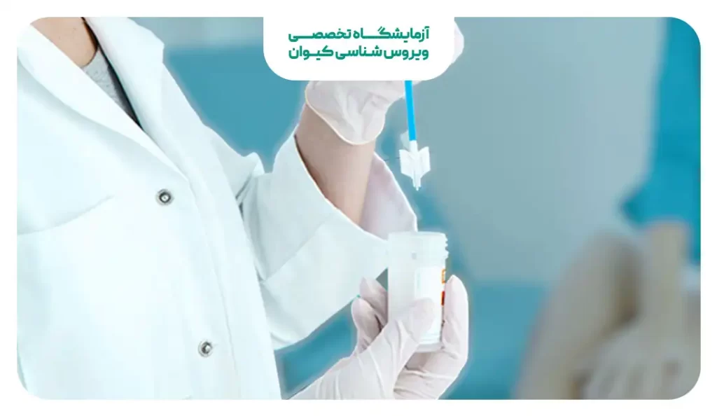 تست پاپ اسمیر تین پرپ