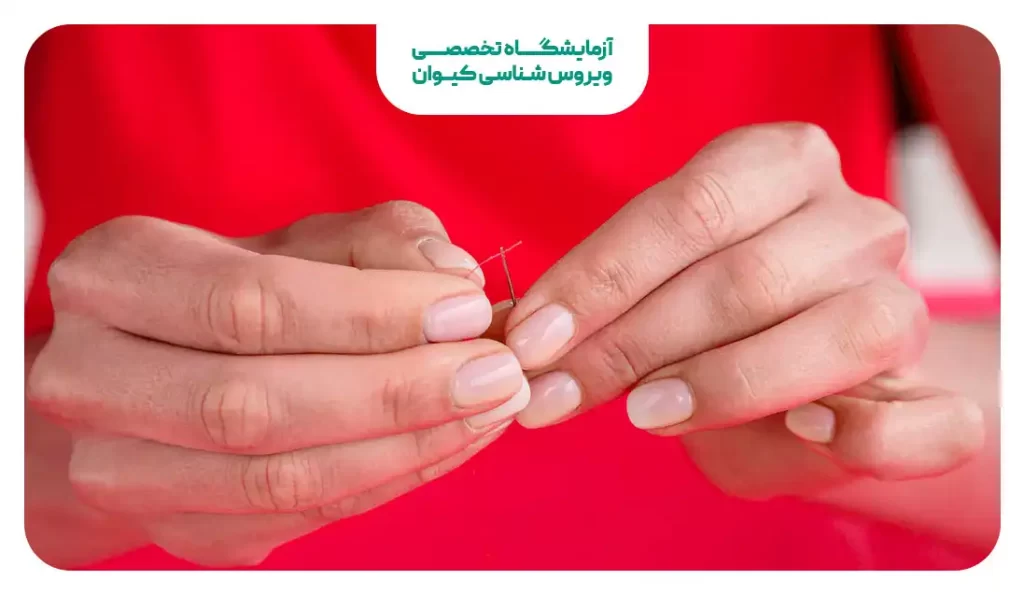 ترمیم پرده بکارت (دوختن)