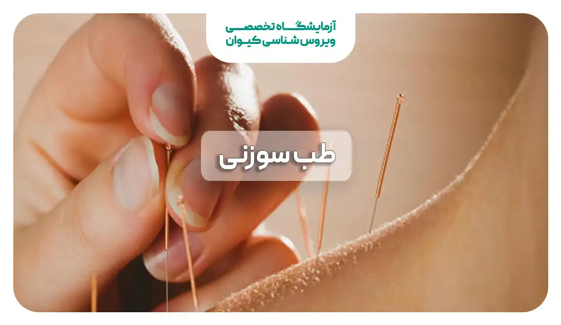 طب سوزنی چیست؟