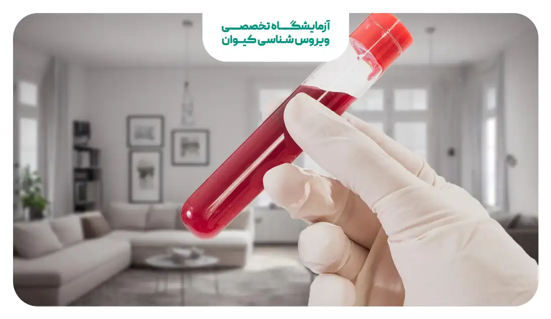 آزمایش خون در منزل