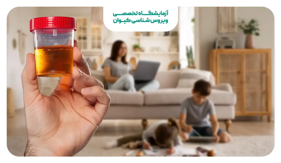 آزمایش ادرار در منزل