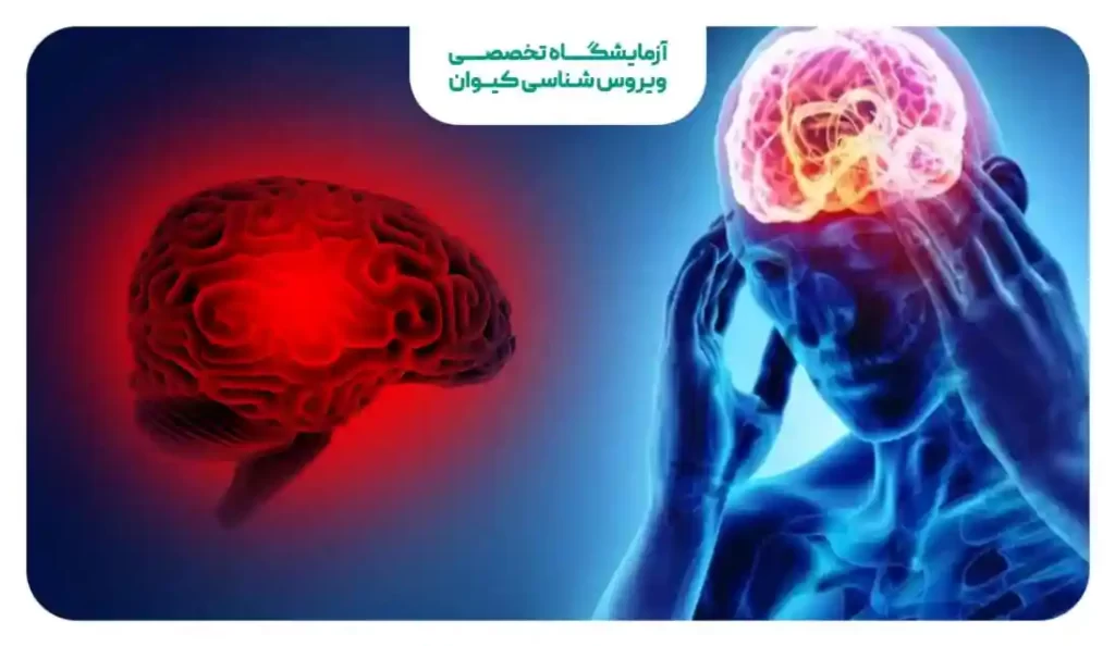 ضربه مغزی چیست؟