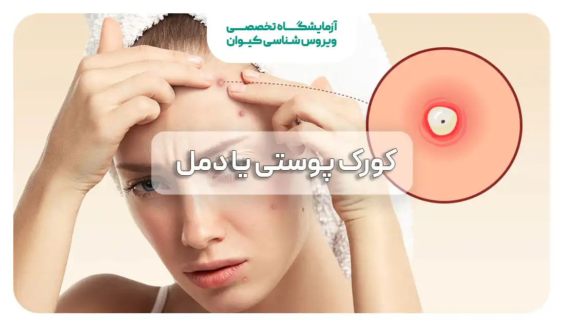 کورک پوستی یا دمل چیست؟