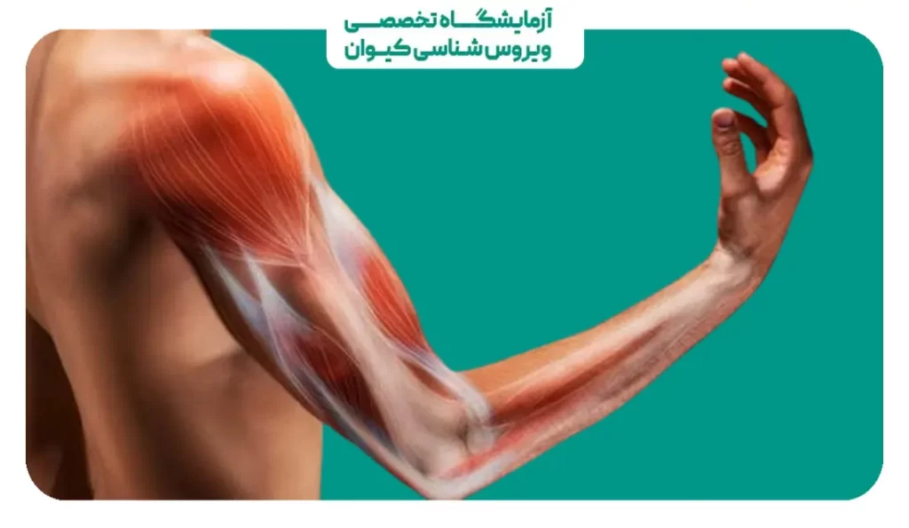 ارتباط دیسک گردن و درد دست راست