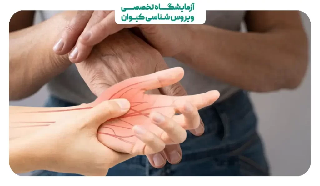 علت درد دست راست