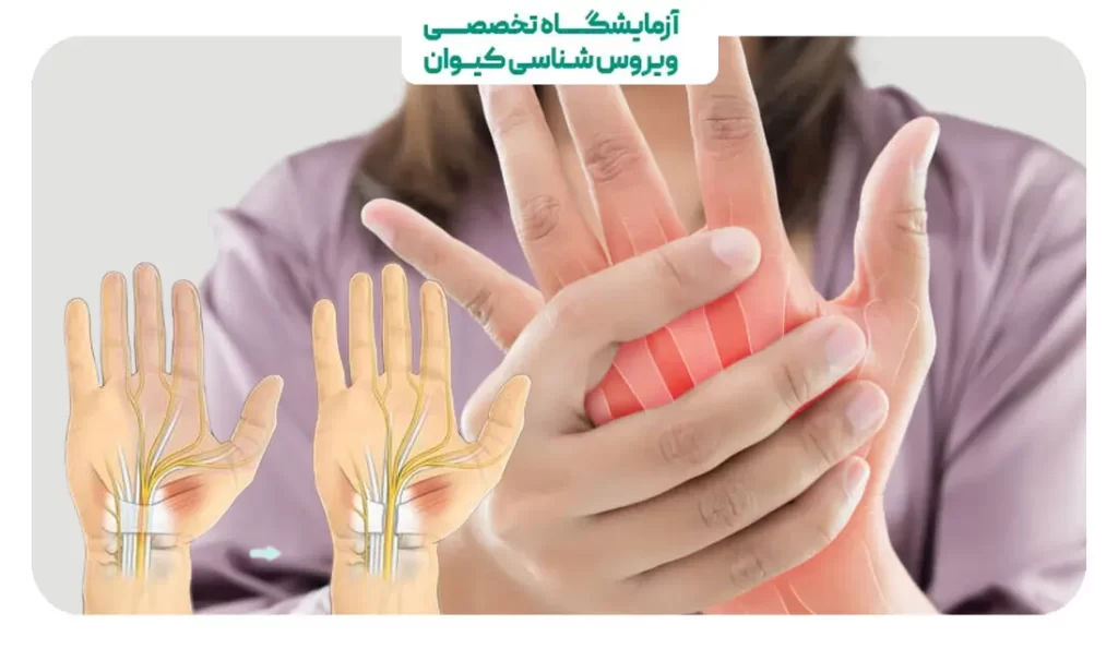 علت درد دست