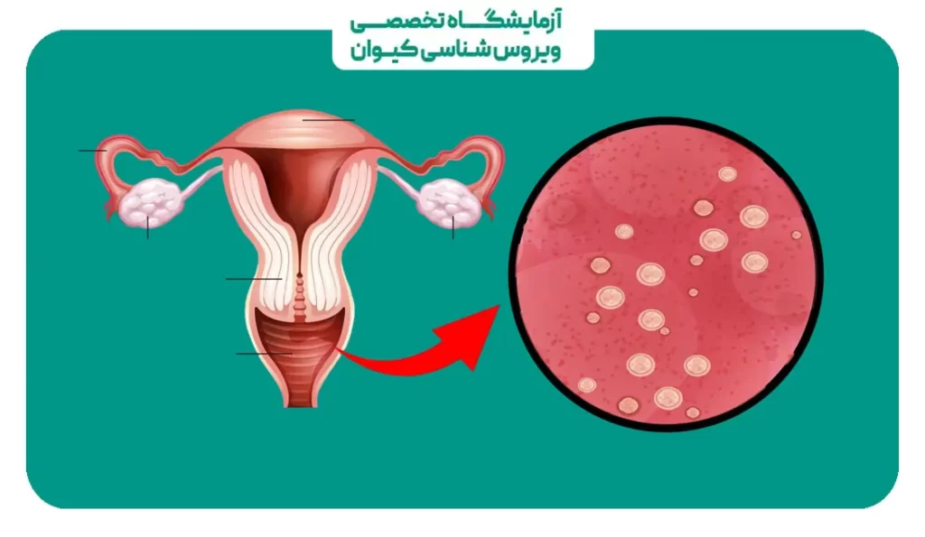 جلوگیری از HPV در واژینال