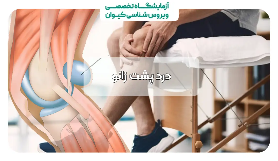 درد پشت زانو