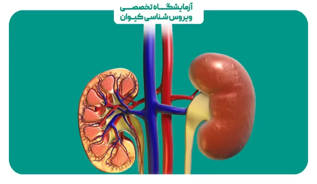 کلیه درد سمت راست