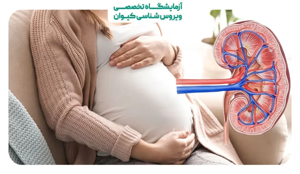 درد کلیه سمت راست در بارداری